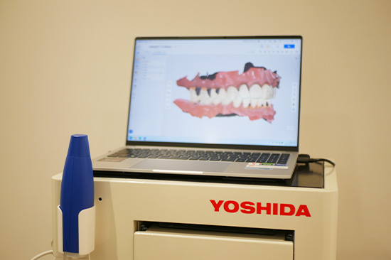 3D光学スキャナー