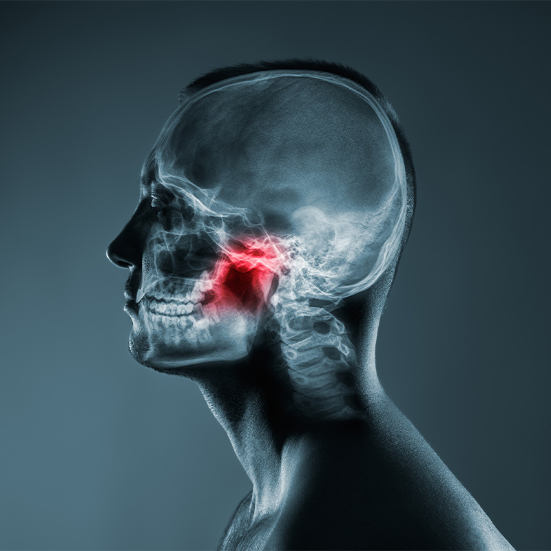 歯ぎしり・食いしばり　